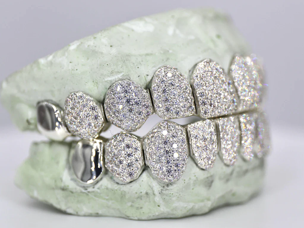 10 ON 10 Capped VVS Moisannite Diamond Grillz - Image 7