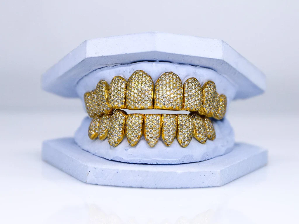 10 ON 10 VVS Moisannite Diamond Grillz - Image 4