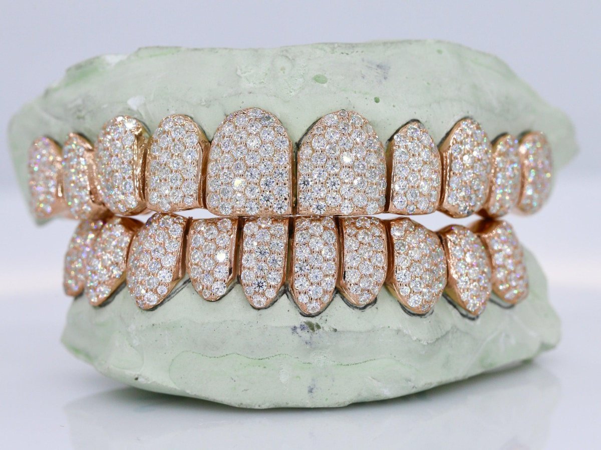 10 on 10 VVS Moisannite Diamond Grillz - Image 4