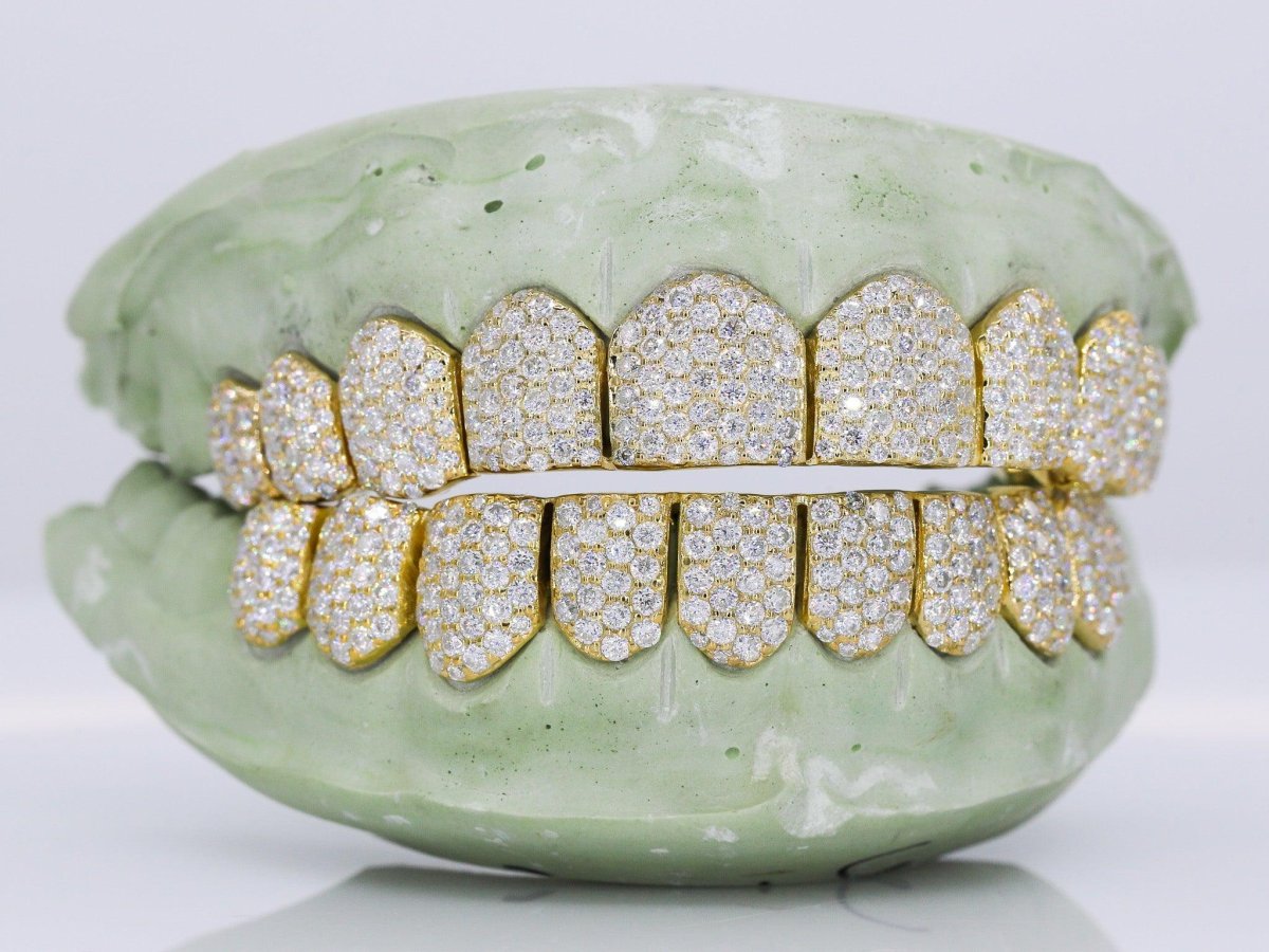 10 on 10 VVS Moisannite Diamond Grillz - Image 7
