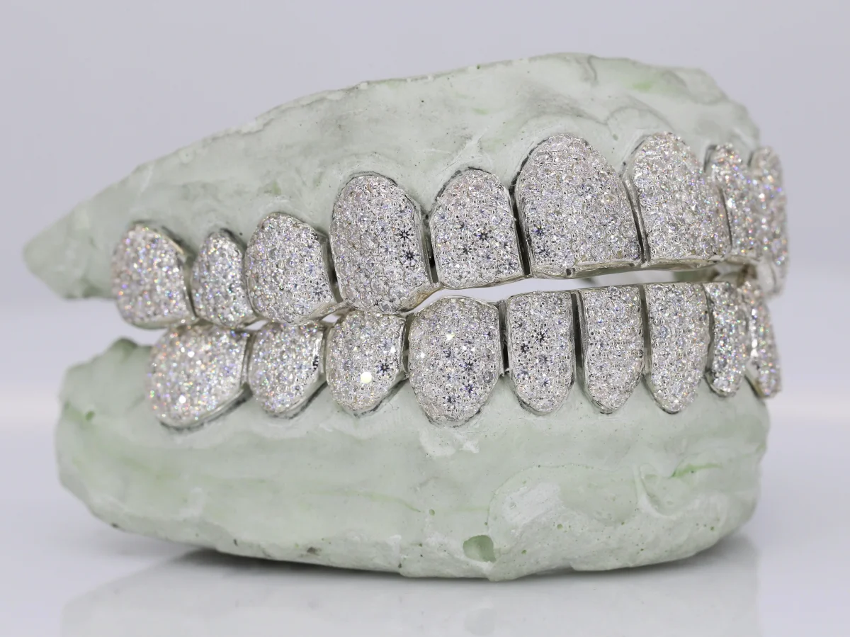 12 on 12 VVS Moisannite Diamond Grillz - Image 4
