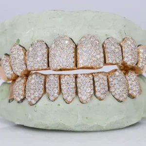 10 ON 10 Capped VVS Moisannite Diamond Grillz